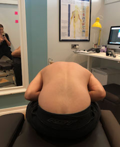 After Chiropractic